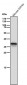 Anti-AKR1C3 Rabbit Monoclonal Antibody